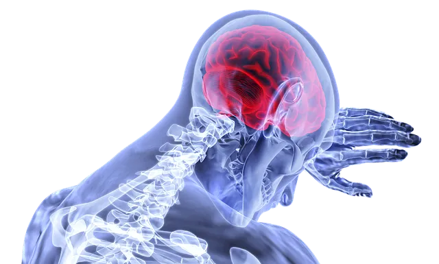 De här är symptomen på en stroke